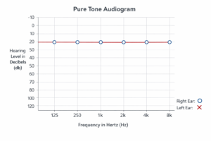 standard pure tone audiogram up to 8khz